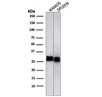 HLA-DRB1 Antibody (MHC II)