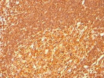 HLA-DRB1 Antibody (MHC II)