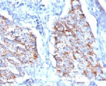 HSP60 Antibody / HSPD1