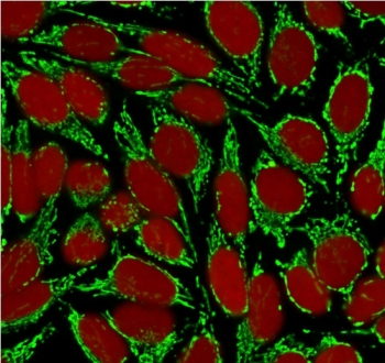 HSP60 Antibody / HSPD1