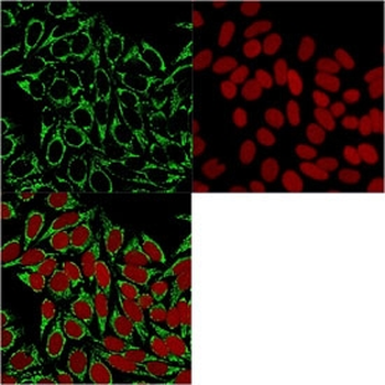 HSP60 Antibody / HSPD1