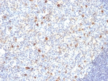 IgM Antibody