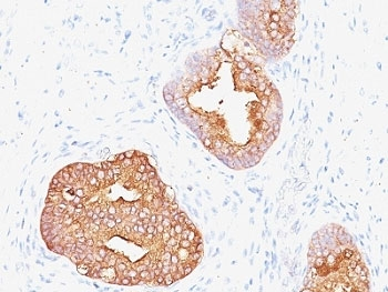Prostate Specific Antigen Antibody