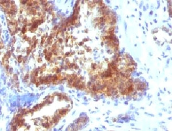 Prostate Specific Antibody / PSA