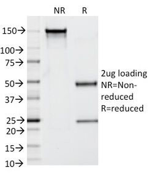 Prostate Specific Antibody / PSA