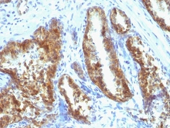 Prostate Specific Antigen Antibody Cocktail