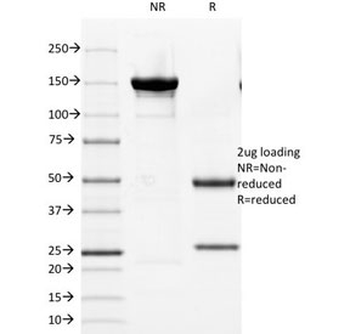 Androgen Receptor Antibody