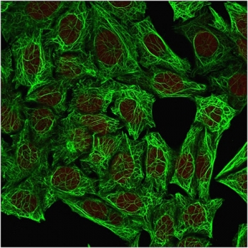 KRT7 Antibody / Cytokeratin 7