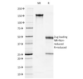 KRT7 Antibody / Cytokeratin 7