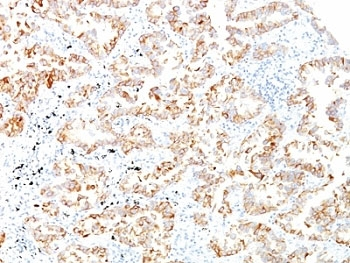 Keratin 7 Antibody