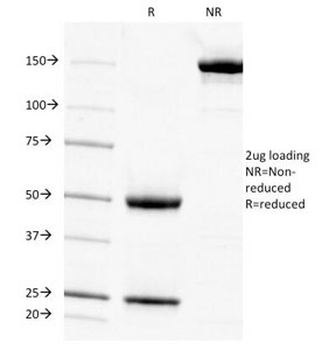 Cytokeratin 7 Antibody
