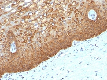 Keratin 14 Antibody