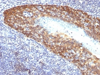 Keratin 14 Antibody