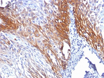 Cytokeratin 17 Antibody (KRT17)