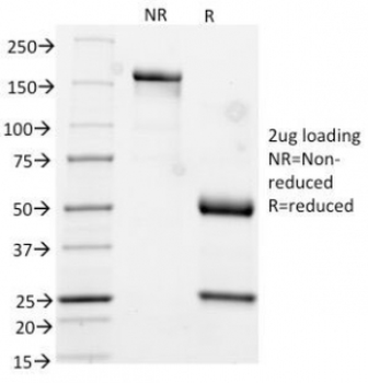 Cytokeratin 17 Antibody (KRT17)