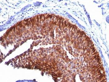 Cytokeratin 17 Antibody (KRT17)
