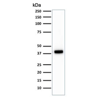 Keratin 18 Antibody