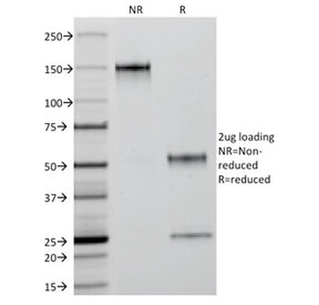 Keratin 18 Antibody