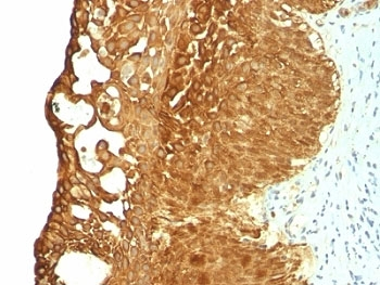KRT19 Antibody / Cytokeratin 19