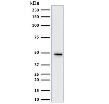 KRT19 Antibody / Cytokeratin 19