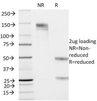 KRT19 Antibody / Cytokeratin 19