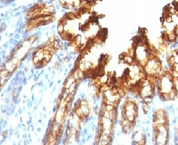 KRT19 Antibody / Cytokeratin 19