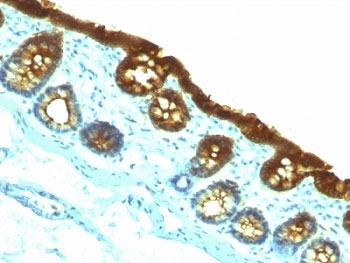 KRT19 Antibody / Cytokeratin 19