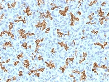 KRT19 Antibody / Cytokeratin 19
