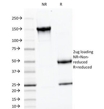 Luteinizing Hormone beta Antibody