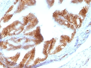 EpCAM Antibody / Cytoplasmic domain