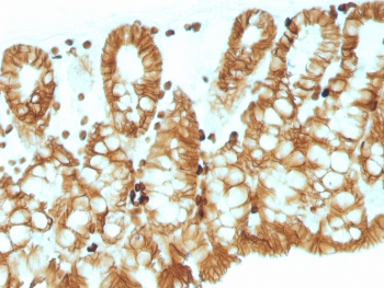 EpCAM Antibody / Cytoplasmic domain