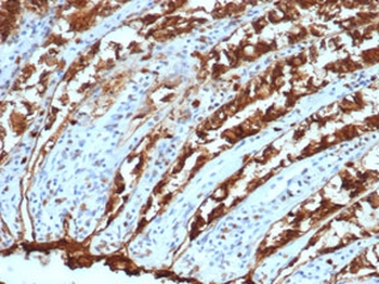EpCAM Antibody / Cytoplasmic domain