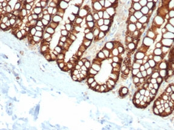 EpCAM Antibody / Cytoplasmic domain