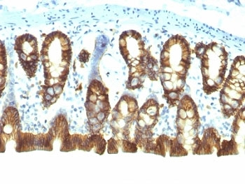 EpCAM Antibody / Cytoplasmic domain