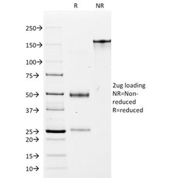 EpCAM Antibody