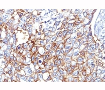 EpCAM Antibody / Extracellular domain