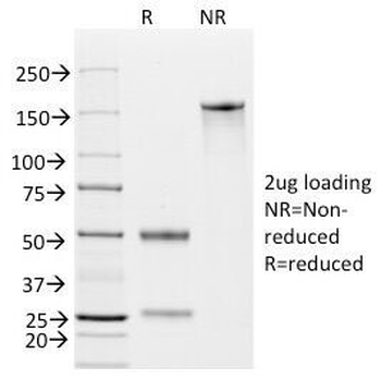 EpCAM Antibody / Extracellular domain