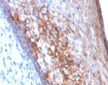 MCAM Antibody / CD146