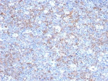 CD146 Antibody