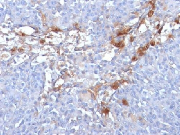CD146 Antibody