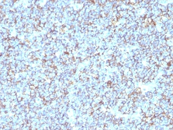 CD99 Antibody