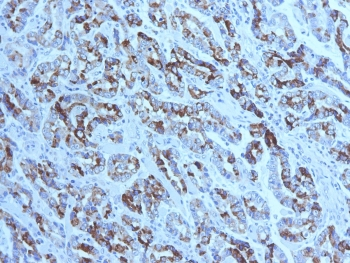 MUC6 Antibody (Gastric Mucin)
