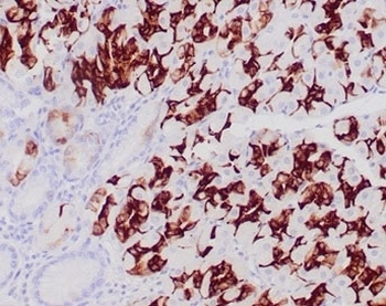 MUC6 Antibody (Gastric Mucin)