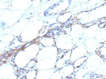 SM-MHC Antibody