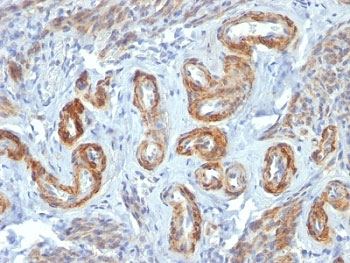 SM-MHC Antibody