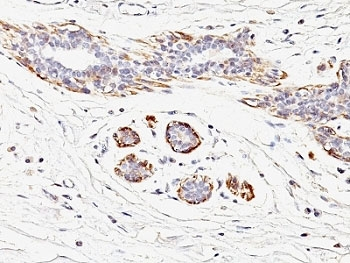 SMMHC Antibody (Smooth Muscle Myosin Heavy Chain)