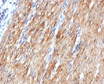 SMMHC Antibody