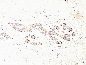 SMMHC Antibody Cocktail