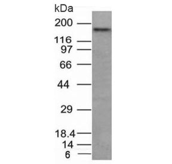 CD56 Antibody / NCAM / Extracellular domain