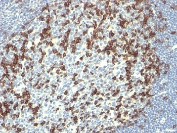 PD-1 Antibody